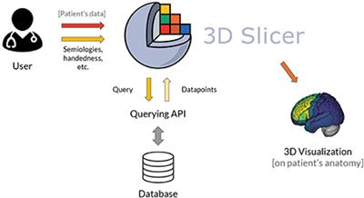 Software tool for visualization of a probabilistic map of the epileptogenic zone from seizure semiologies